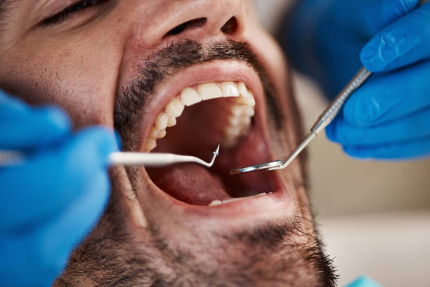 Best Emergency Treatment for Dental Infections or Abscesses in Brooklyn, IN